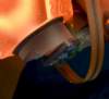 hg1700ag13gg1308_laser_block_glowing_detector_closeup1_small.jpg